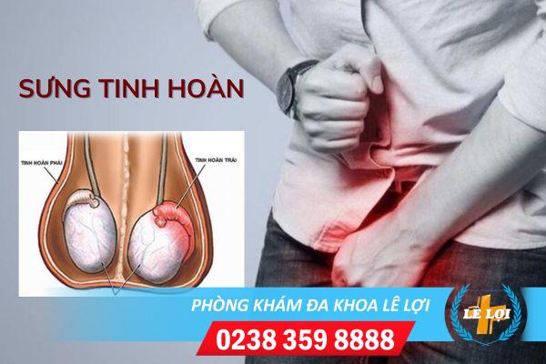 Sưng tinh hoàn là bị bệnh gì nguy hiểm không?