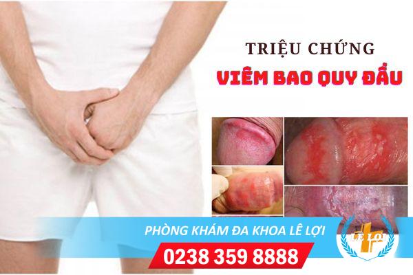 viem-bao-quy-dau-o-nam-gioi-nguy-hiem-khong-2 (2)