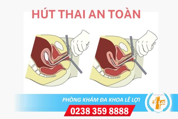 Địa chỉ hút thai ở đâu an toàn chi phí bao nhiêu?