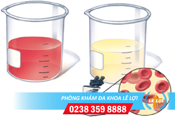 Tiểu ra máu ở nữ là bị bệnh gì?