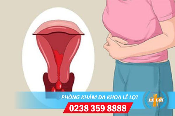 Cách trị rong kinh hiệu quả an toàn