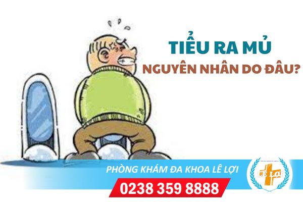 Tiểu ra mủ là bệnh gì nguy hiểm không?