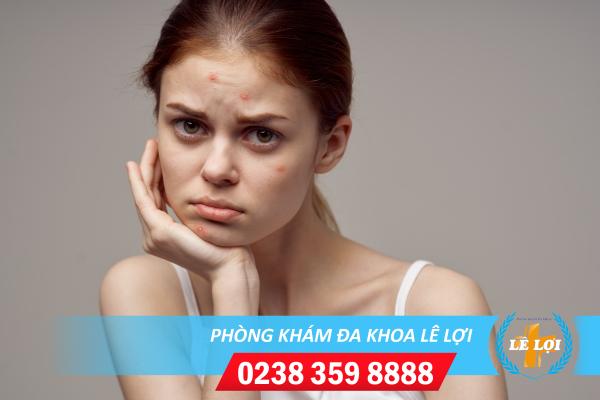 Phòng khám da liễu uy tín tại Nghệ An