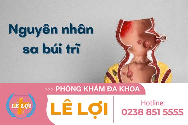 Nguyên nhân sa búi trĩ và cách điều trị
