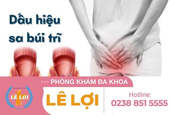Sa Búi Trĩ, Triệu Chứng Và Phương Pháp Điều Trị Hiệu Quả