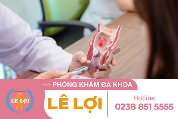 Địa chỉ khám trĩ ngoài giờ – giá không đổi