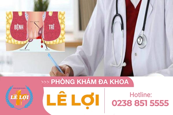 Bệnh viện khám trĩ uy tín đúng giá tại Vinh