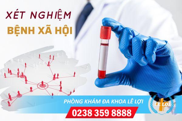 Những hạng mục cần làm khi đi xét nghiệm bệnh xã hội