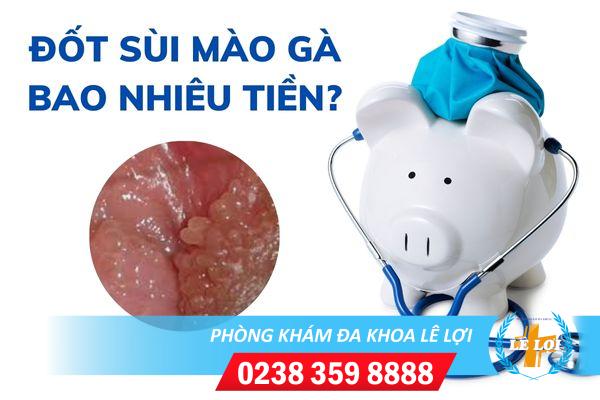 Chi phí đốt sùi mào gà bao nhiêu?