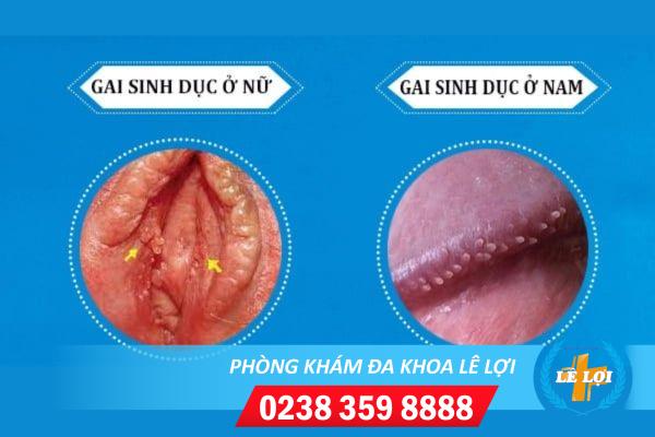 gai-sinh-duc