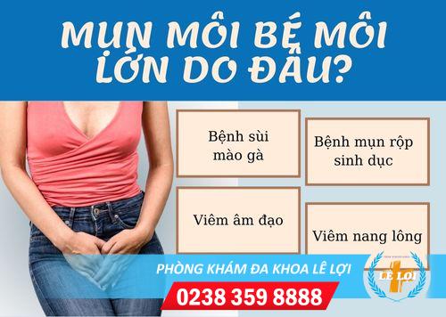 Hết sức lưu ý tình trạng mọc mụn môi bé, môi lớn