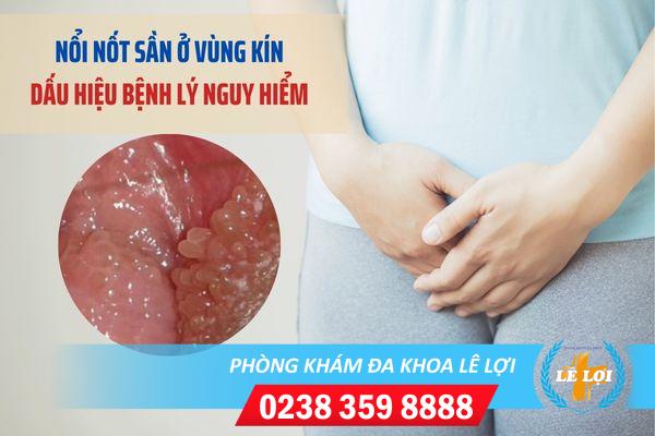 Nốt sần ở vùng kín phải làm sao?