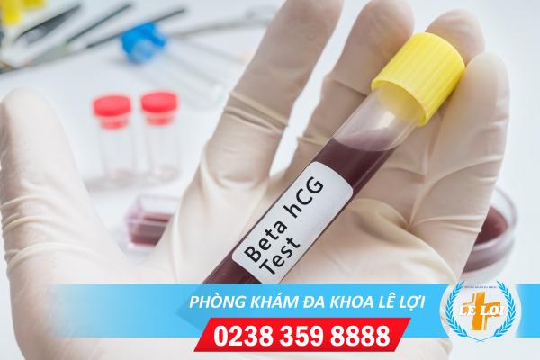 Xét nghiệm beta HCG là gì? Các vấn đề cần lưu ý khi thực hiện xét nghiệm