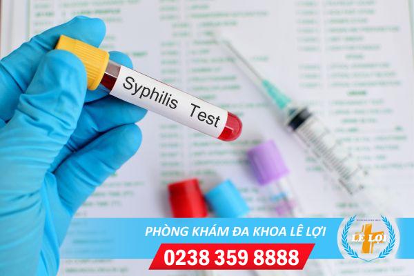 Xét nghiệm giang mai ở đâu tại Tp Vinh Nghệ An