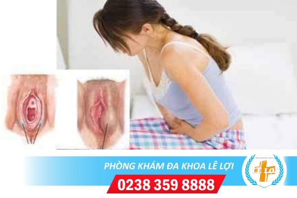 Áp xe vùng kín âm đạo nguy hiểm không?