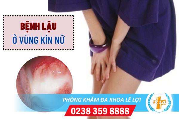 benh-lau-o-vung-kin-nu