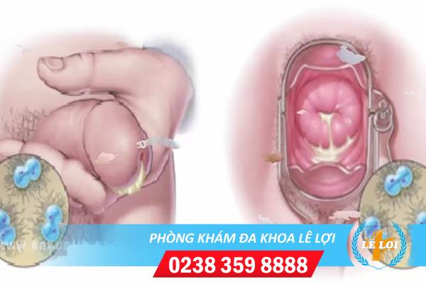 Cần làm gì khi bị vùng kín chảy mủ?