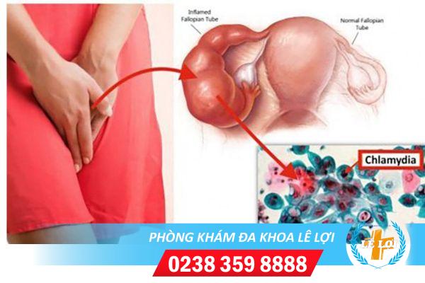 Xét nghiệm chlamydia ở đâu chính xác chi phí bao nhiêu?
