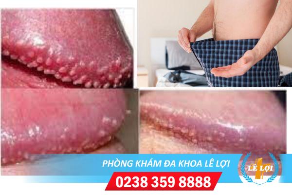 chuoi-hat-ngoc-duong-vat