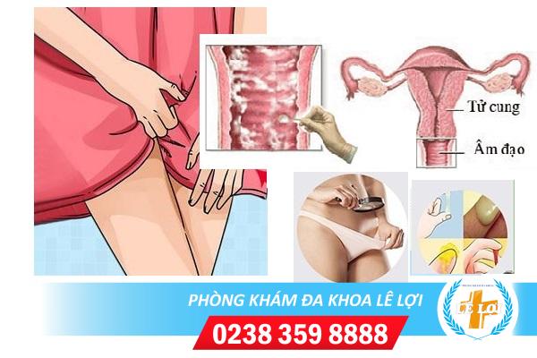 Đau rát bộ phận sinh dục nữ là bị bệnh gì?