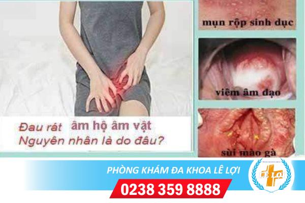 Đau rát âm hộ âm vật là bị gì nguy hiểm không?