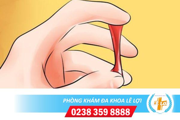 Dịch âm đạo màu đỏ có máu là biểu hiện của bệnh gì?