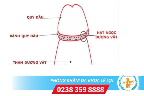 Triệu chứng điển hình của bệnh hạt ngọc dương vật