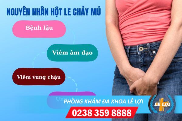 Hột le chảy mủ là bệnh gì?