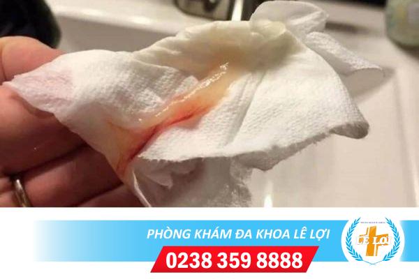 Ra huyết trắng màu hồng có nguy hiểm không?