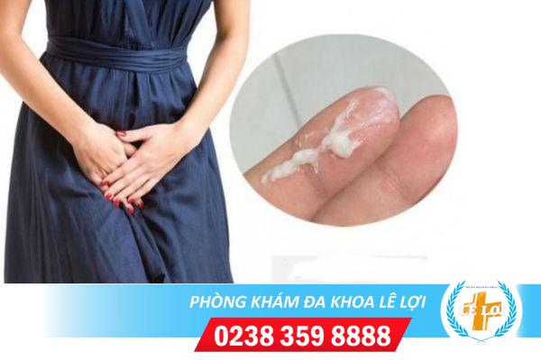 Ra khí hư ngứa là bị gì?