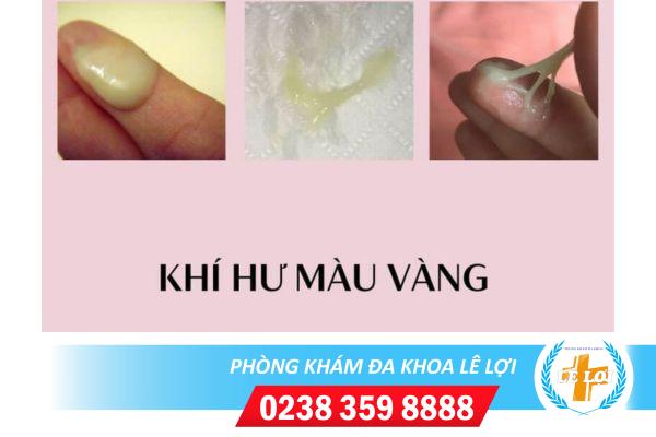 Ra dịch âm đạo màu vàng có phải mắc bệnh phụ khoa?