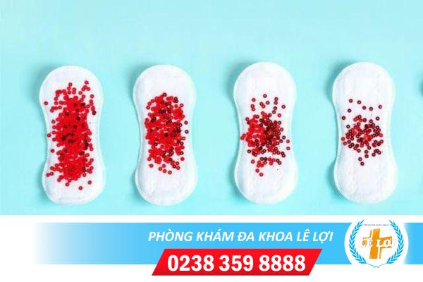 Dấu hiệu kinh nguyệt bất thường và cách điều trị