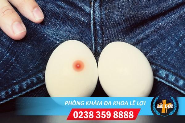 Nổi mụn ở tinh hoàn là dấu hiệu bệnh gì và cách chữa trị