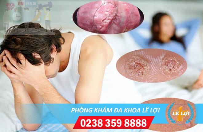 mun-coc-duong-vat-5