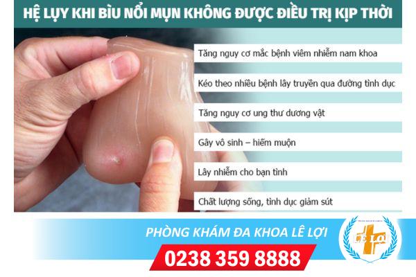 Nổi mụn cứng ở bìu là bị bệnh gì?