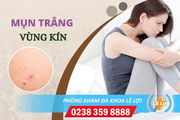 Nguyên nhân nổi mụn trắng vùng kín và cách điều trị