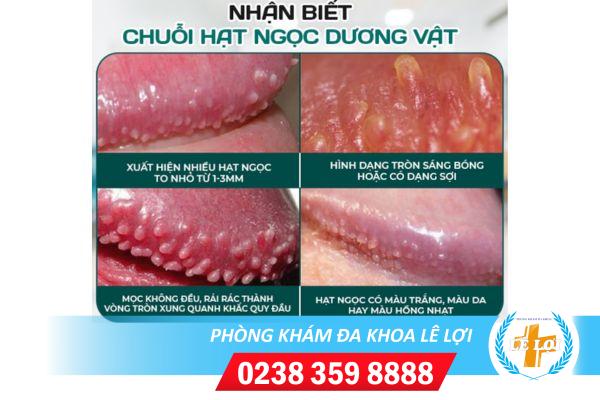 Điểm danh những nguyên nhân gây nổi mụn nhọt quy đầu