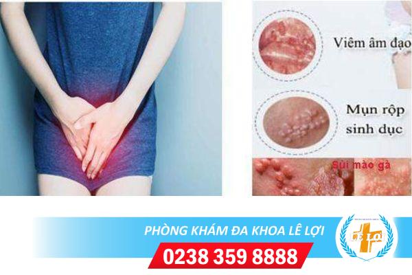 Nổi hạt trắng ở hạt le là bệnh gì điều trị ra sao?