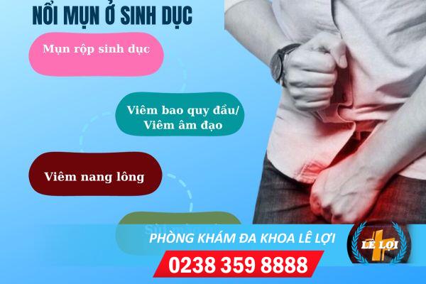 Nổi mụn sinh dục – điều trị sớm để tránh biến chứng