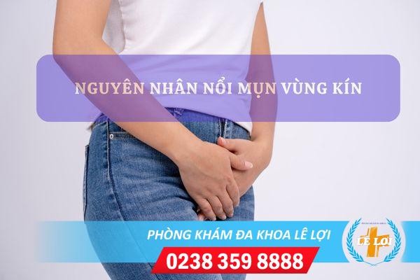 Trị mụn vùng kín bằng cách nào?