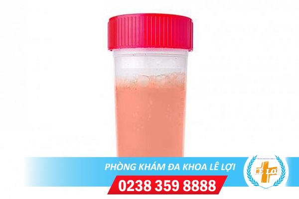 Nước tiểu màu đỏ hồng ở nữ là bị gì?