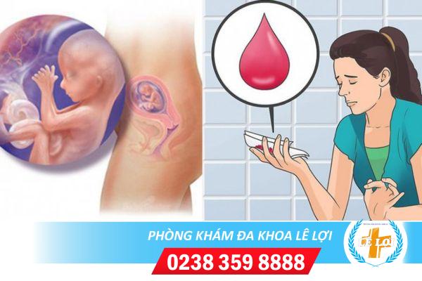 Nguyên nhân sảy thai, dấu hiệu và cách xử lý