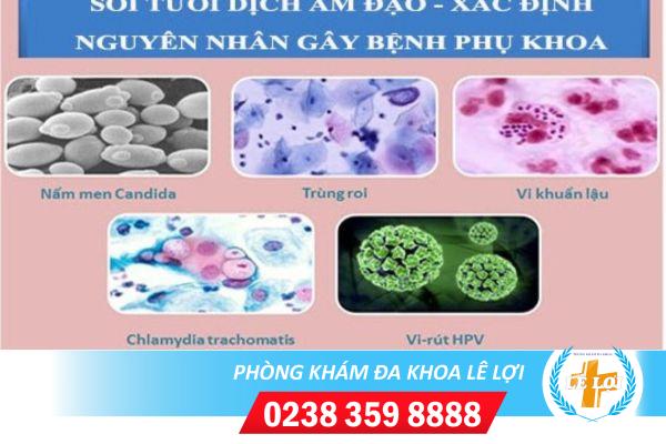 Xét nghiệm phụ khoa soi tươi dịch âm đạo ở đâu?