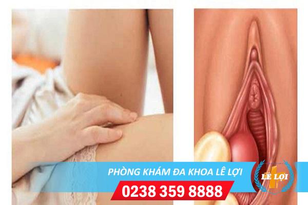 Bộ phận sinh dục nữ bị sưng do đâu và cách điều trị
