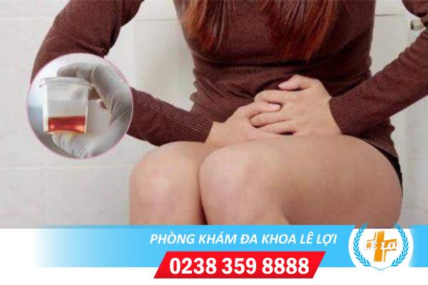 Tiểu buốt ra máu ở nữ là bệnh gì nguy hiểm không?