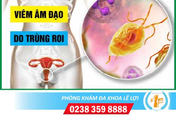 Nhiễm trùng roi âm đạo chữa thế nào?