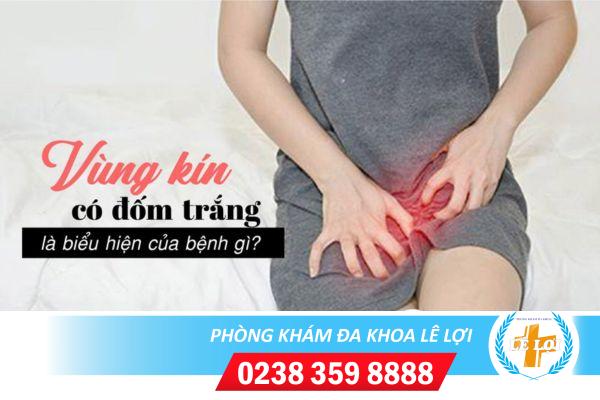 Nguyên nhân gây đốm trắng vùng kín và cách điều trị