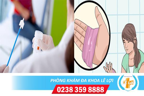 Xét nghiệm phụ khoa soi tươi dịch âm đạo ở đâu?