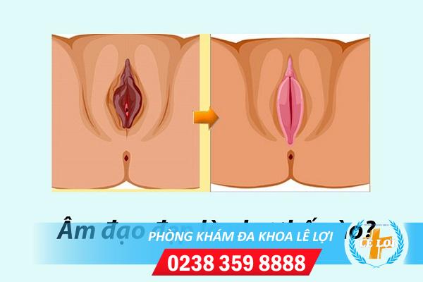 Làm đẹp âm đạo vùng kín bí quyết lấy lại sự tự tin cho phái đẹp
