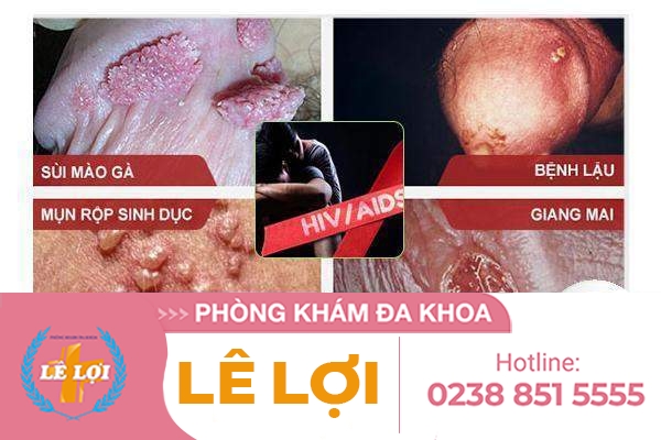 benh-xa-hoi-trieu-chung